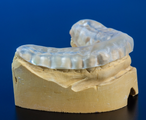 Clear nightguard resting on model of the teeth